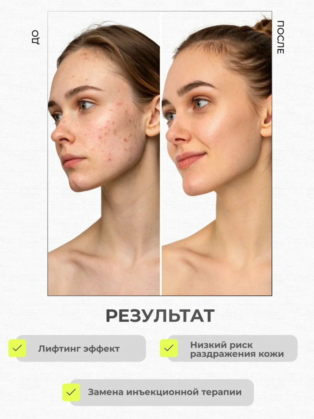 Лифтинг крем для лица Celimax, с микроиглами и ретинолом — фото 1