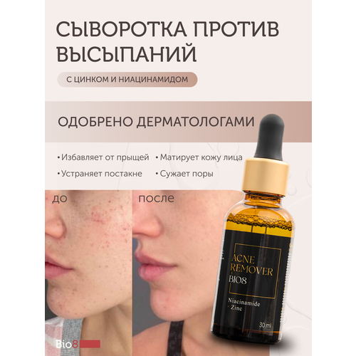 Сыворотка для лица 