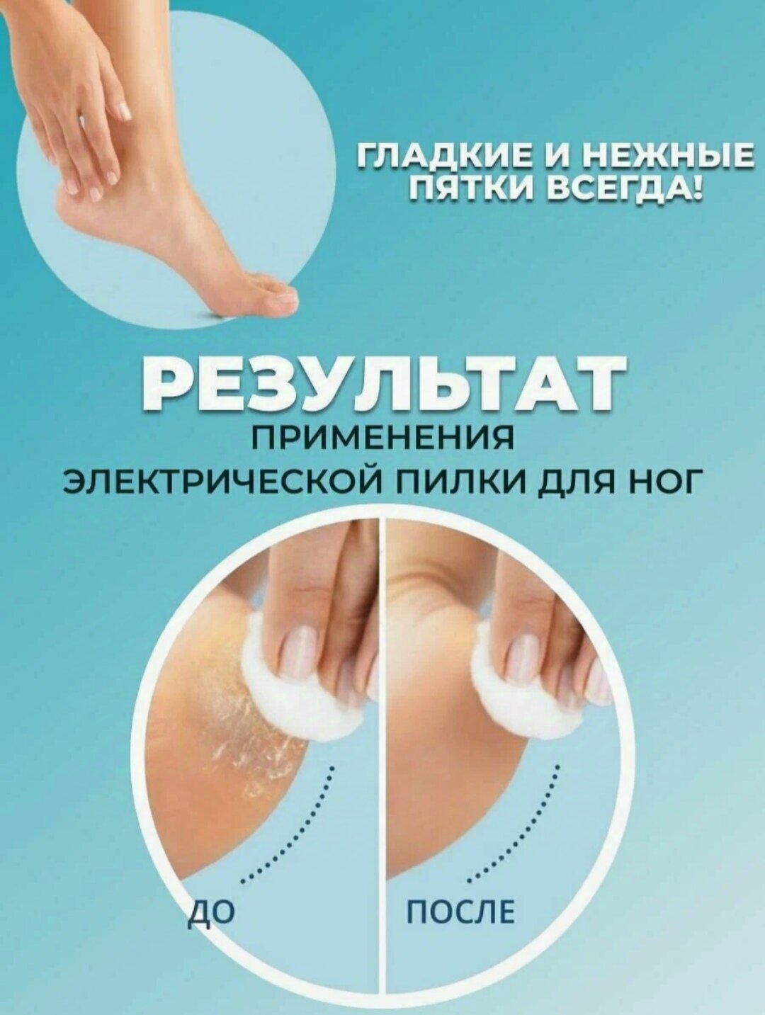 Изображение Электрическая роликовая пилка для пяток пилка для педикюра VITTOVAR