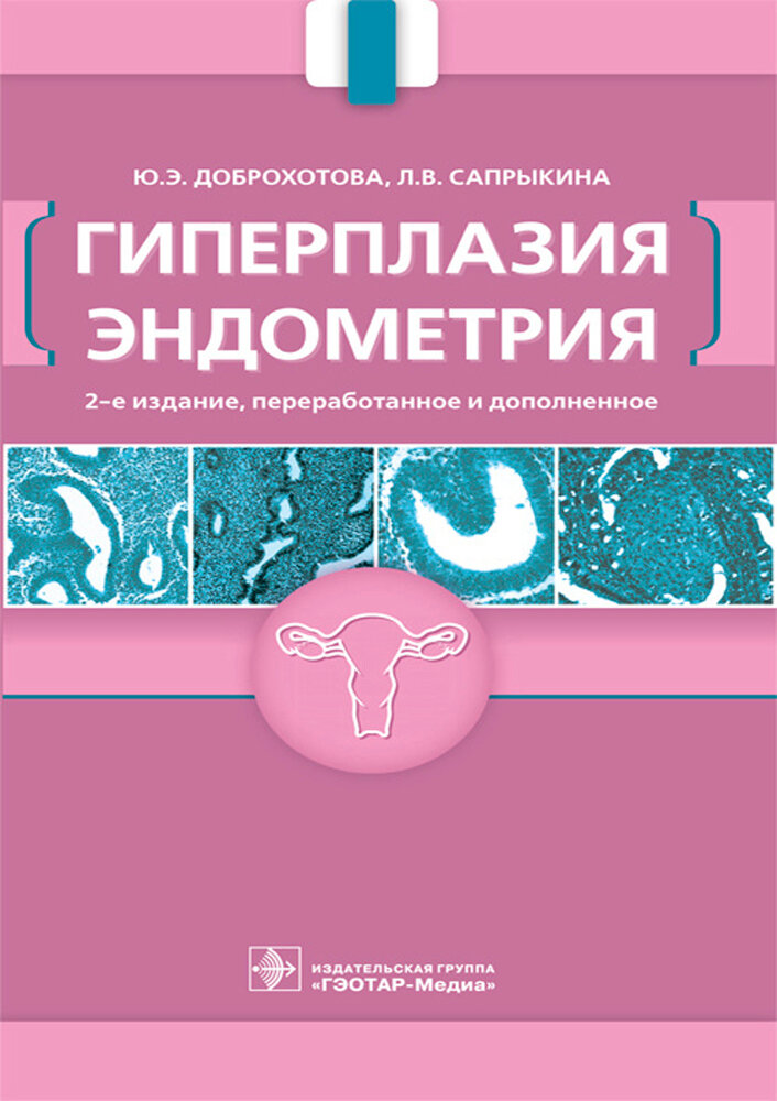 Гиперплазия эндометрия (Доброхотова Юлия Эдуардовна, Сапрыкина Людмила Витальевна) - фото №2