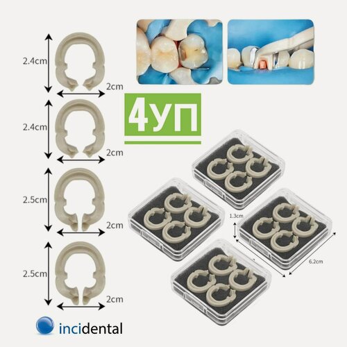 Изображение товара InciClamp / Resin Molding Clip - Стоматологические матричные кольца , Матрицедержатель - Incidental : (зажимное/разделяющее кольцо , Тип: A & B) (контурные секционные из смолы ) , Инсидентал . Набор 4 уп , (1 уп ; 4 шт ).