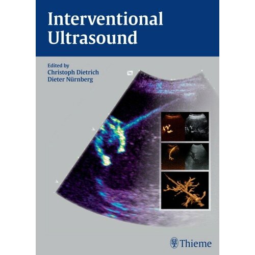 Christoph Frank Dietrich "Interventional Ultrasound: A Practical Guide and Atlas"