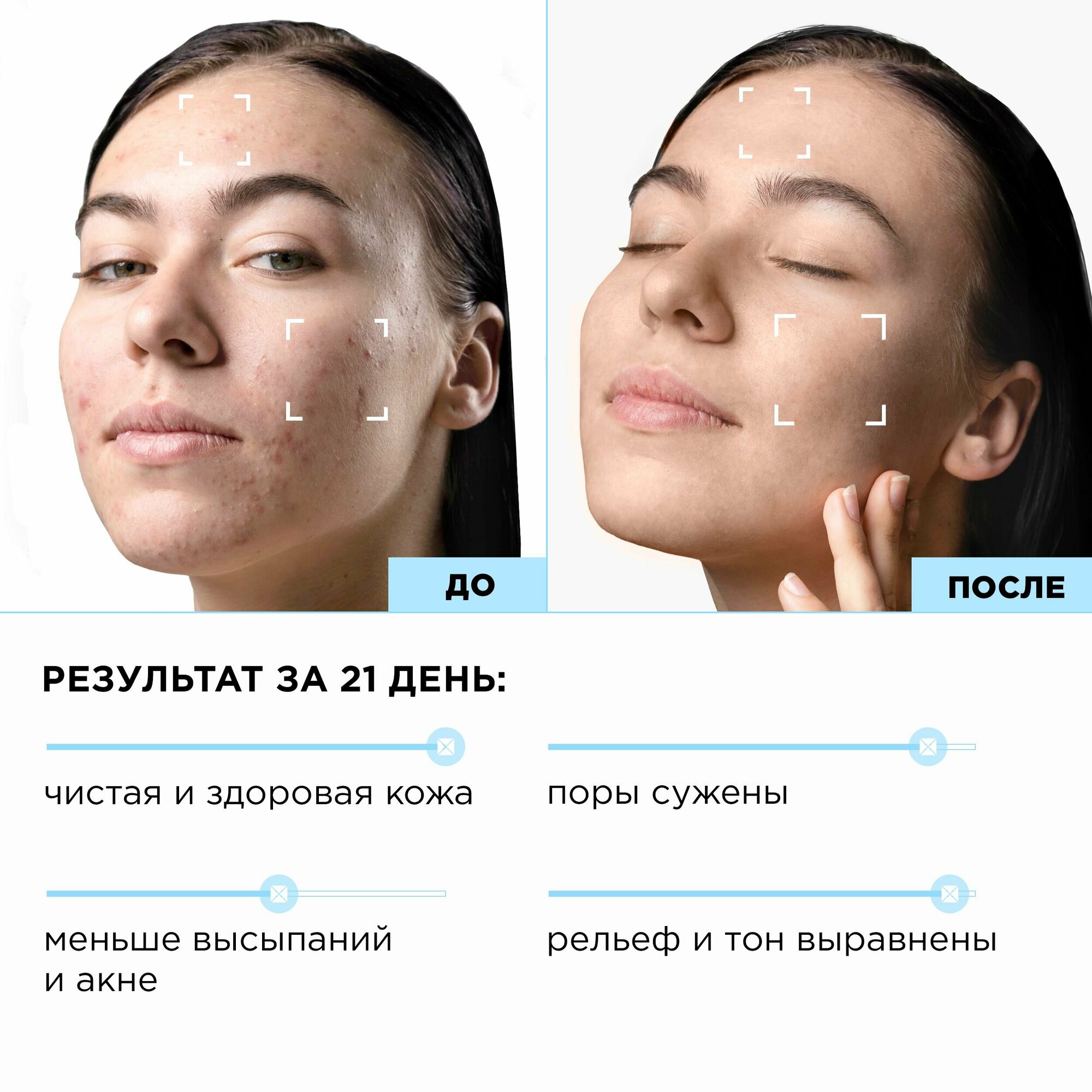 Полиш для лица MiXiT Your Skin Normal to Dry Деликатный 75мл - фото №2