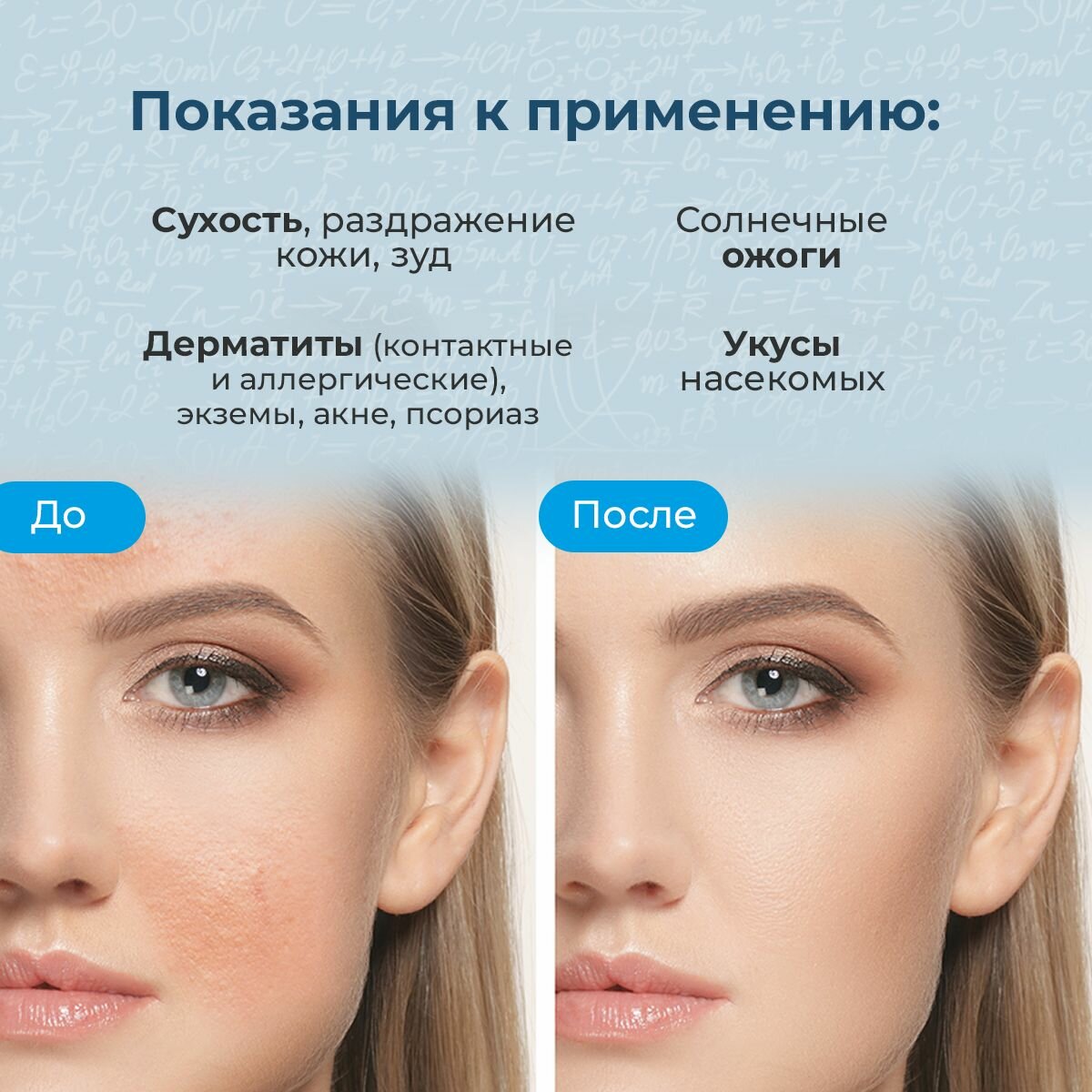 Изображение Redox термальная минеральная вода с аллантоином и гиалуроновой кислотой