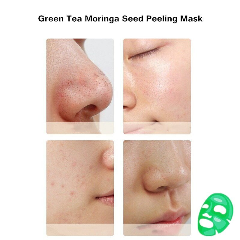 Прокладки Послеродовые 40 г SUDAJI Original Face Skin Care Green Tea Gel Mask Nose Blackhead Remover Deep Cleansing Shrink Pore Acne Treatment Cream
