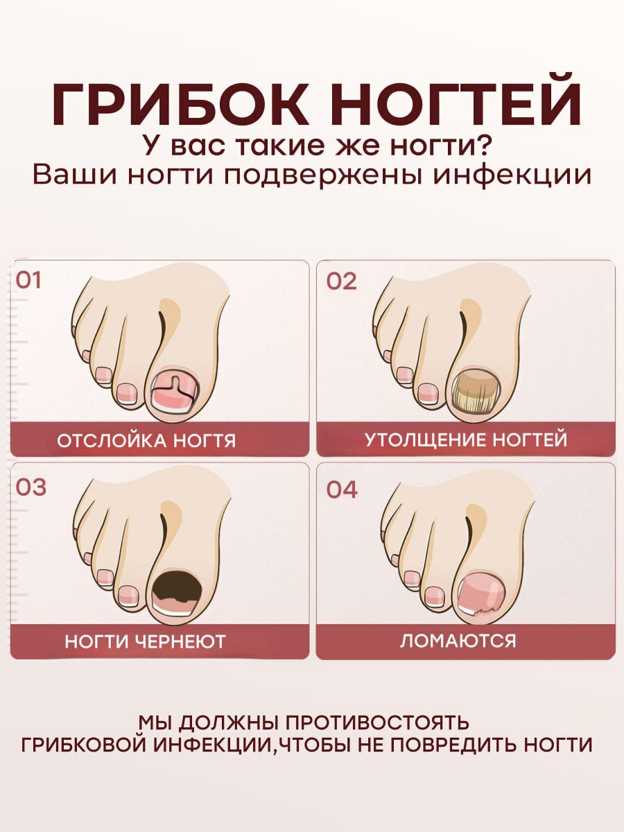 Картинки Средство от грибка ногтей на ногах Lanbena с экстрактом монарды / Уход за ногтями / Ланбена противогрибковое, на русском