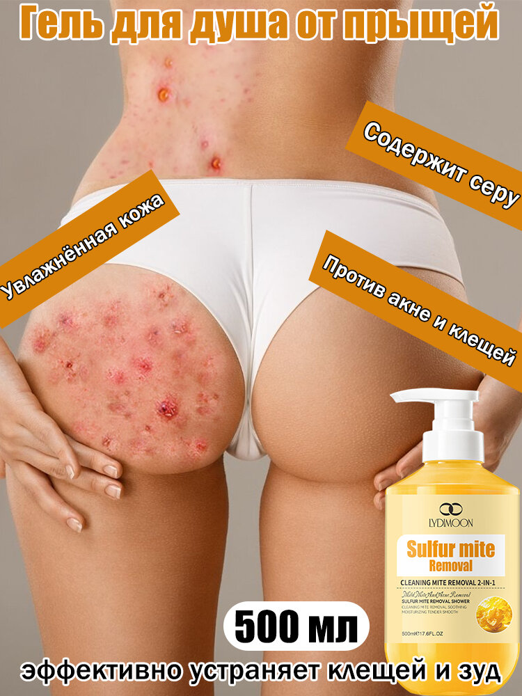 LYDIMOON Гель для душа от прыщей 500 мл против несовершенств кожи, Глубоко очищает кожу тела, эффективно устраняет клещей и зуд, Содержит серу.