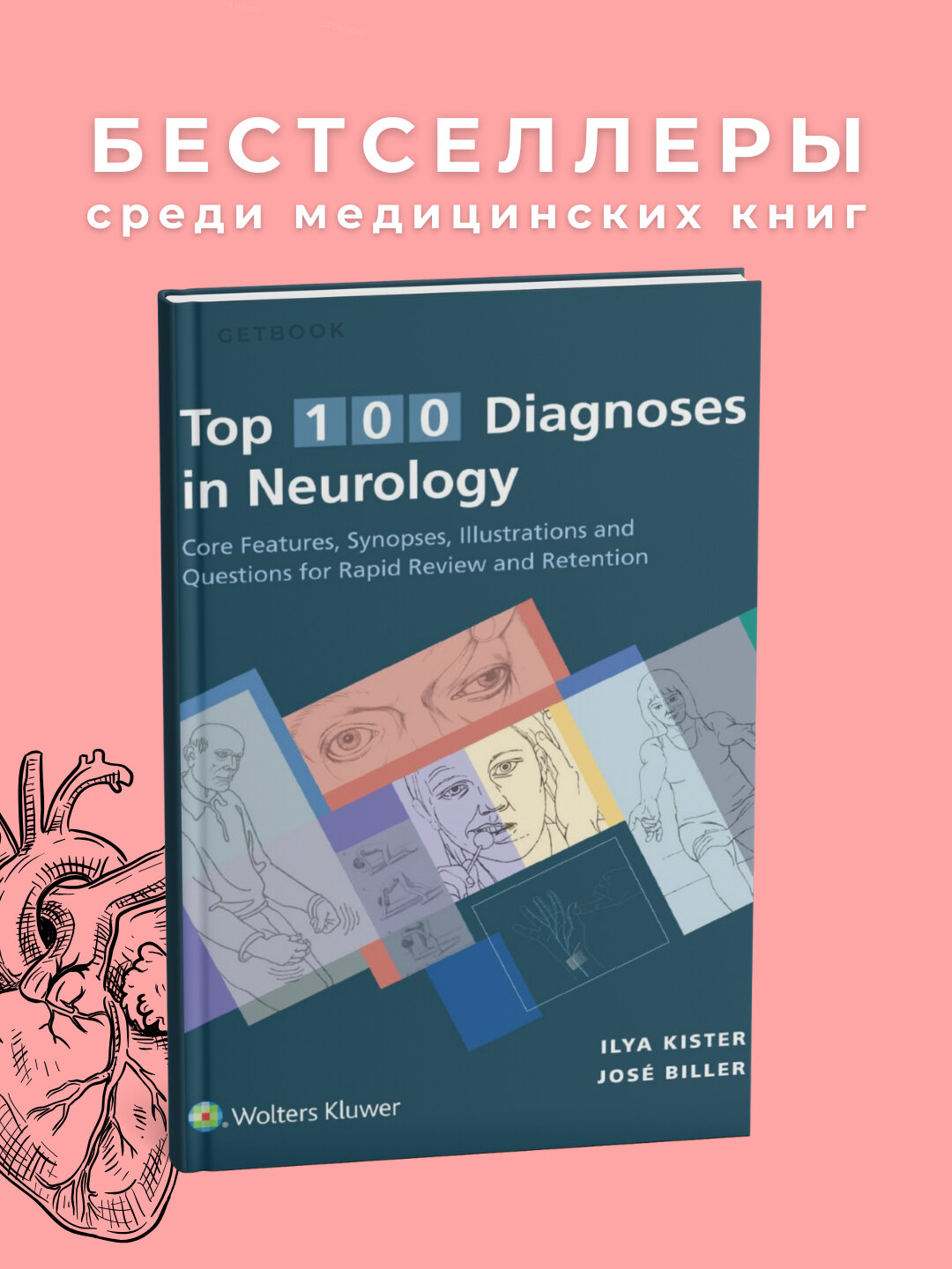 Книга "Top 100 Diagnoses in Neurology", 2021, мягкий переплет
