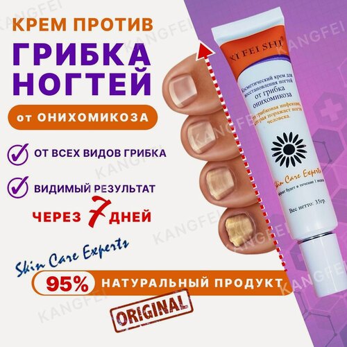 Изображение товара Крем от грибка ногтей на руках и ногах, противогрибковая мазь от онихомикоза, антибактериальный эффект