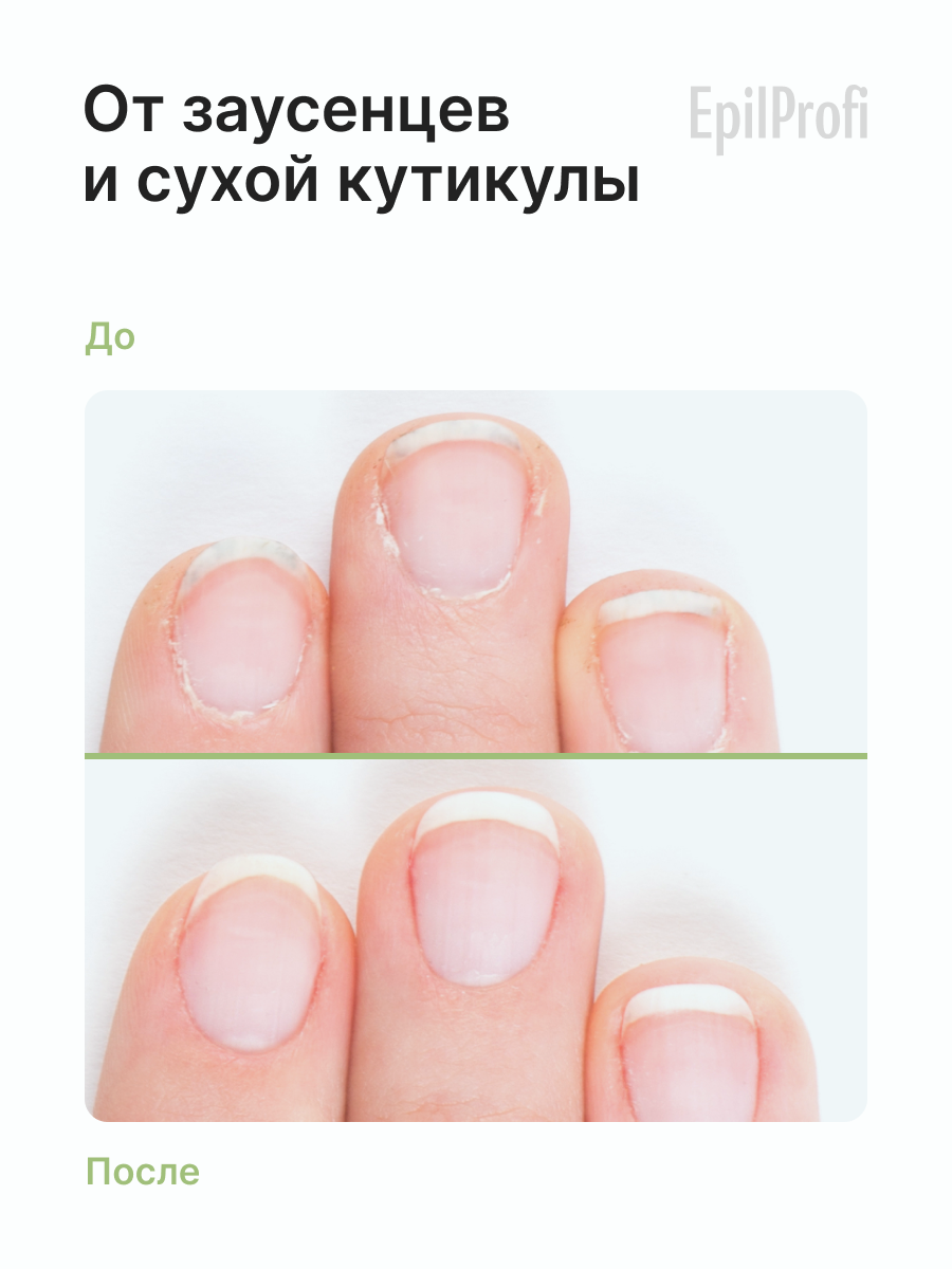 EPILPROFI Масло для кутикулы с эфирным маслом чайного дерева, 10 мл — фото 1