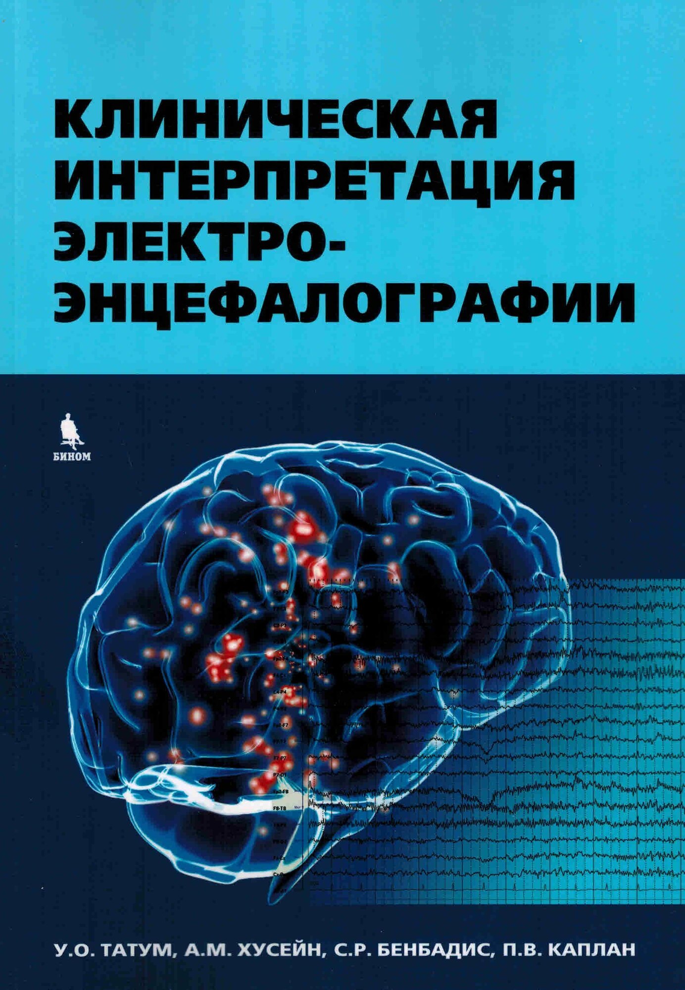 Клиническая интерпретация электроэнцефалографии