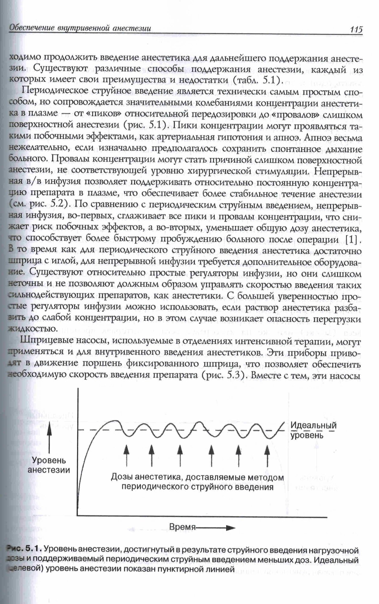 Тотальная внутривенная анестезия — фото 1