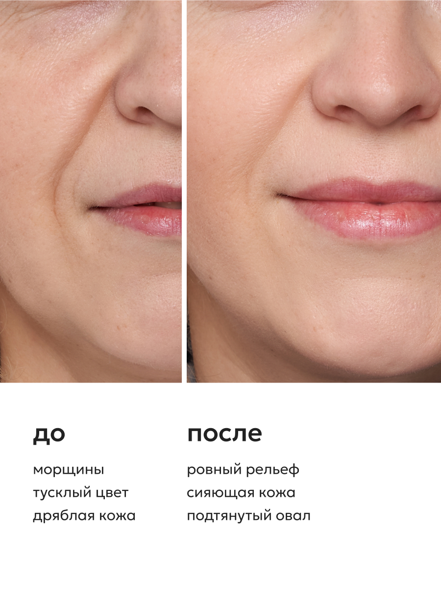 Likato Professional Маска для лица против морщин с ботокс эффектом, 50 мл. *2 шт. — фото 1