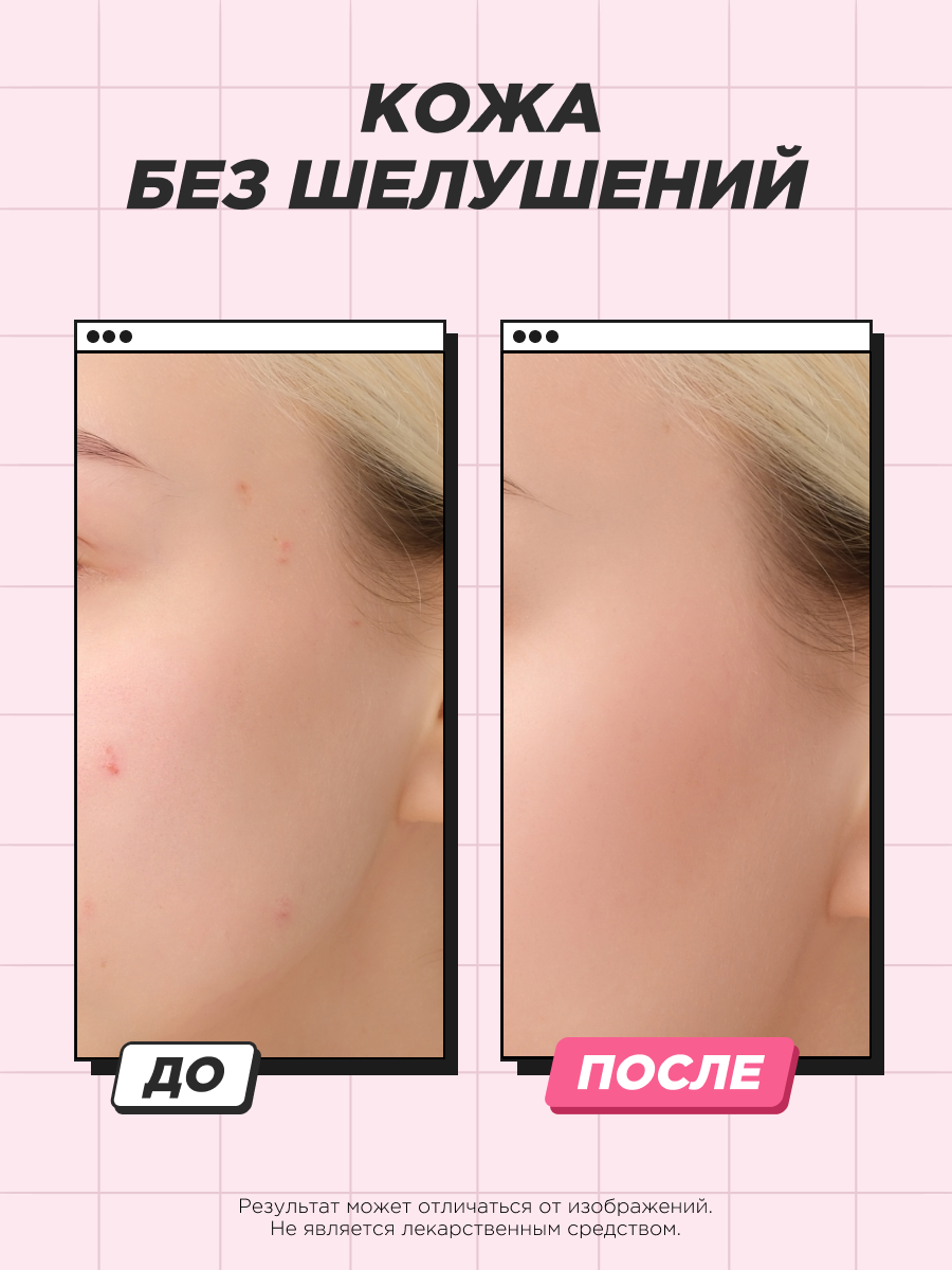 Изображение SENTENSLAB /Сыворотка для лица с гликолевой кислотой ниацинамидом против прыщей акне угрей для проблемной кожи