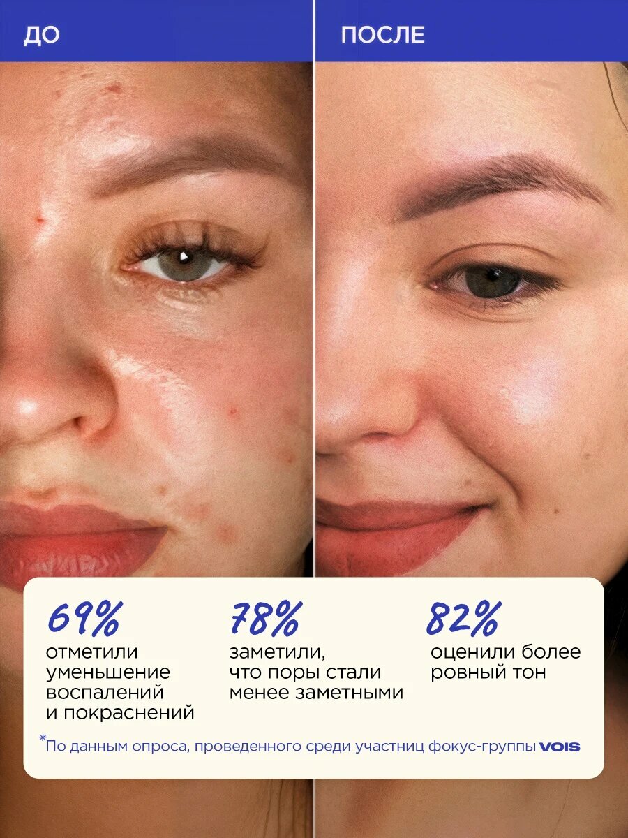 Изображение VOIS Сыворотка для лица от прыщей и черных точек, с ниацинамидом и цинком, противовоспалительная 30 мл