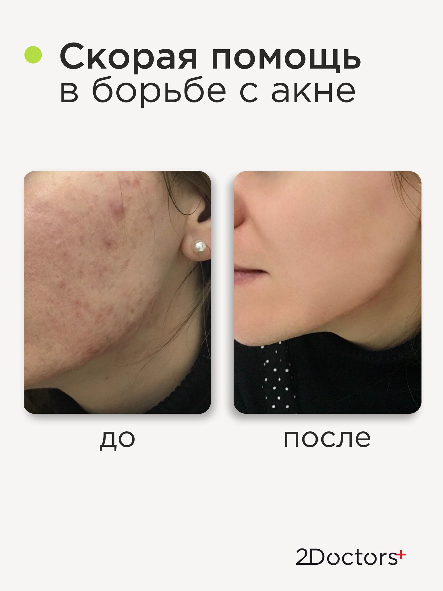 Сыворотка для лица "AHA Кислоты + цинк PCA" 2Doctors №16, от прыщей, 30мл — фото 1