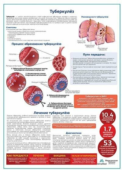 Туберкулёз медицинский плакат, глянцевая фотобумага от 200 г/кв. м, размер A1+