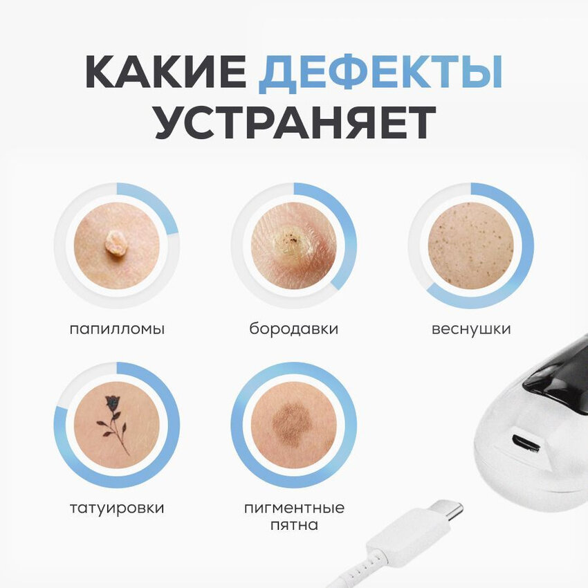 Аппарат косметологический Laconico, для удаления папиллом/бородавок/веснушек, белый, 1 шт — фото 1