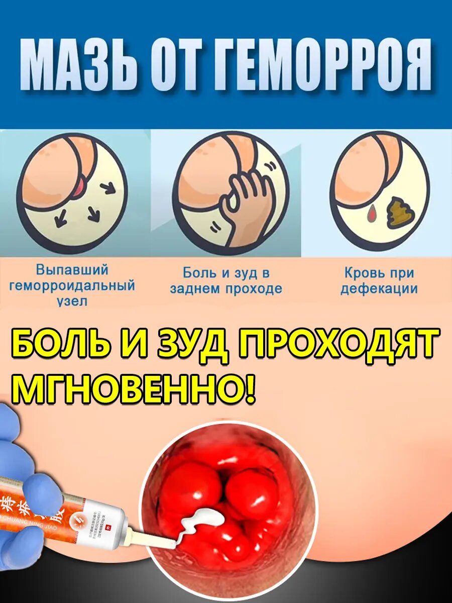 Мазь от геморроя и трещин с мускусом