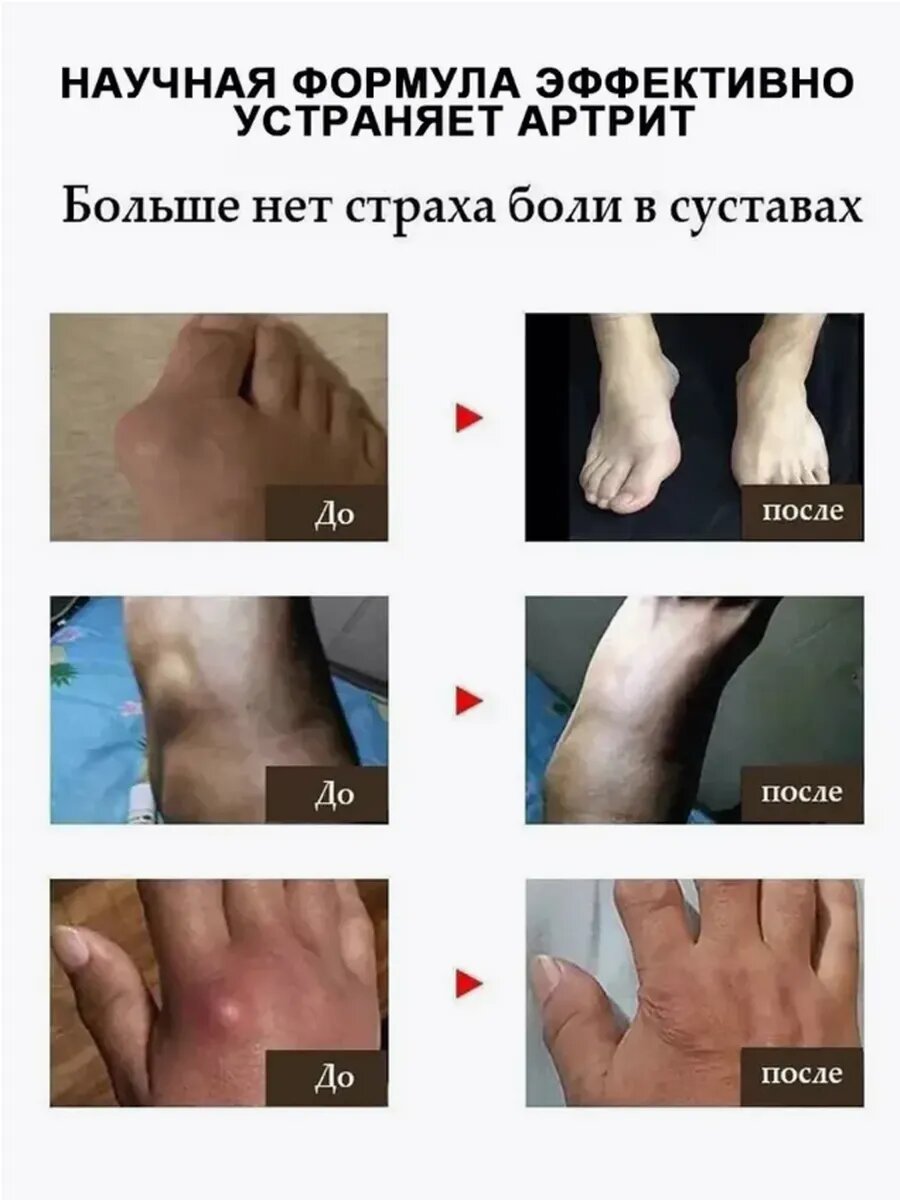 Изображение Мазь от подагры 55г