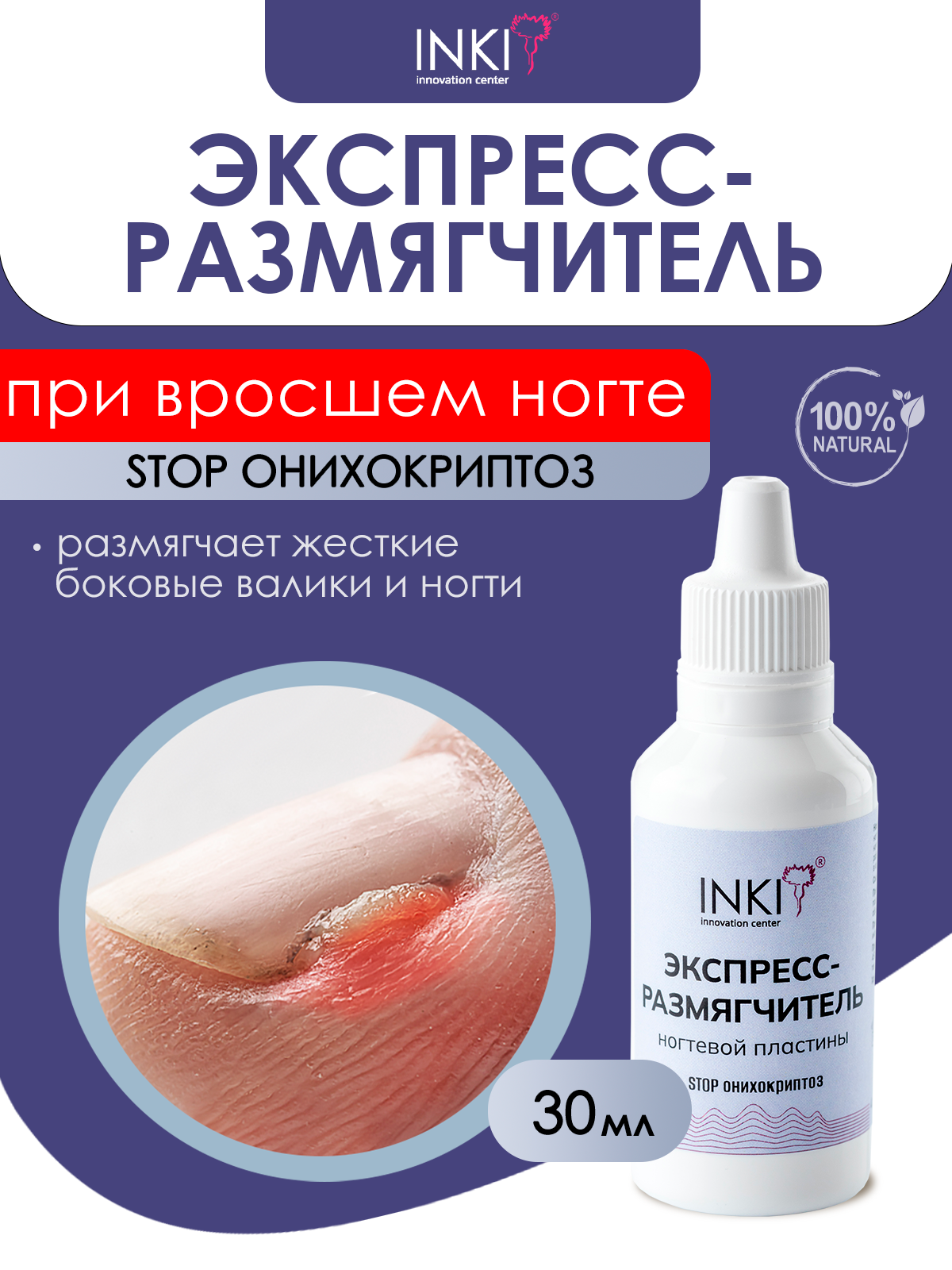 Экспресс-размягчитель вросших ногтей на ногах и руках "STOP Онихокриптоз", 30 мл