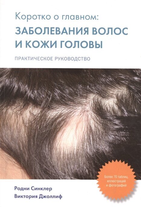 Коротко о главном: заболевания волос и кожи головы