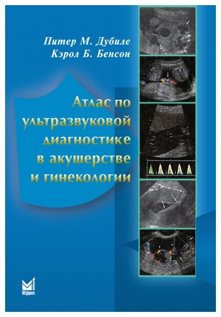 Атлас по ультразвуковой диагностике в акушерстве и гинекологии