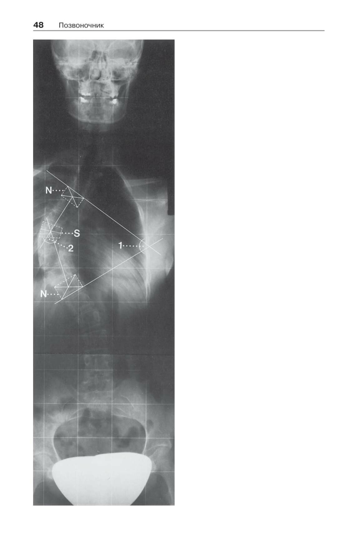 Норма при рентгенологических исследованиях / 3-е изд. - фото №8