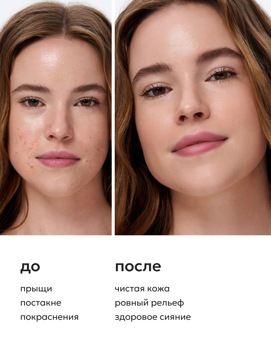 Likato Professional / Сыворотка-концентрат от прыщей для лица и тела, 110 мл — фото 1
