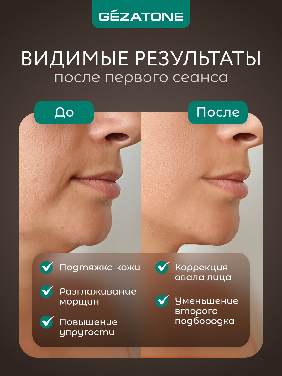 Картинки Gezatone, Аппарат для RF-лифтинга, массажер миостимулятор для лица RF-1607