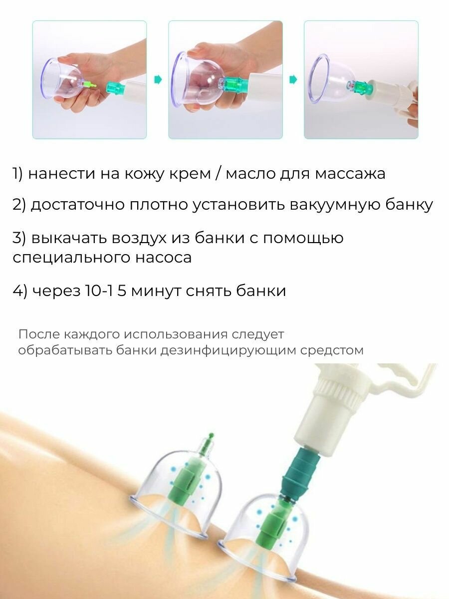Вакуумные банки. 20 января 2019 г. / ПРОДОЛЖЕНИЕ 15 января 2019 г. Ч 3. Болячки после банок.