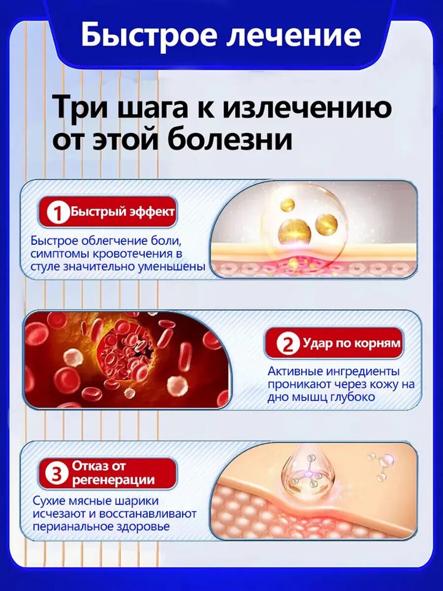 Изображение Китай мази суппозитории от геморроя и анальных трещин