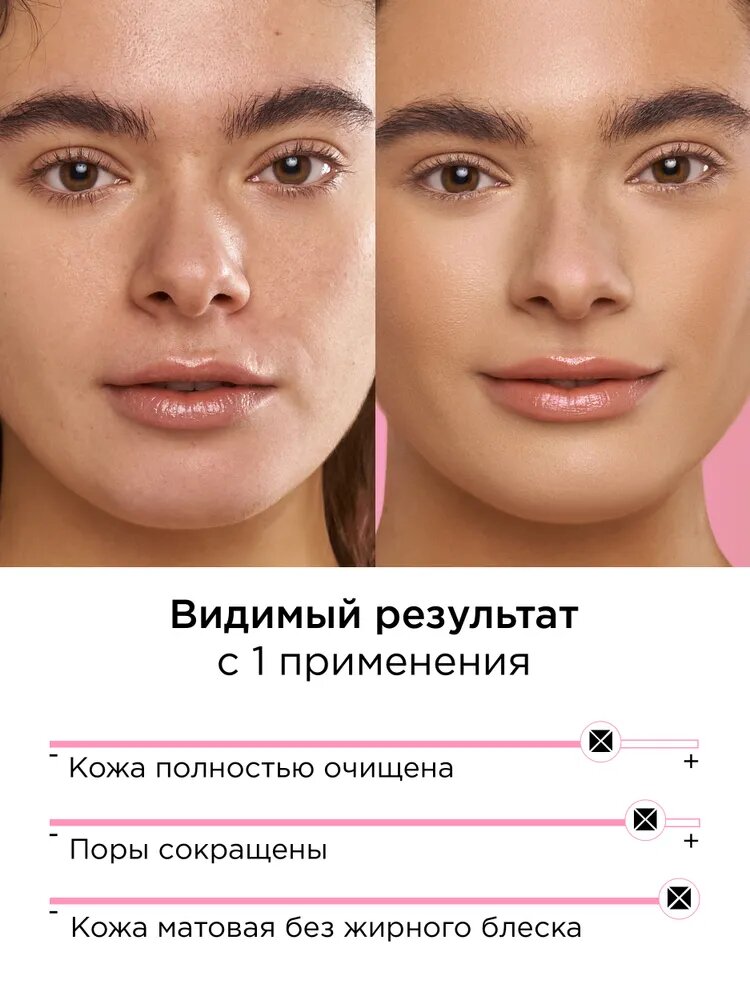MIXIT Очищающий гель для умывания лица матирующий постакне YOUR SKIN, 150 мл — фото 1