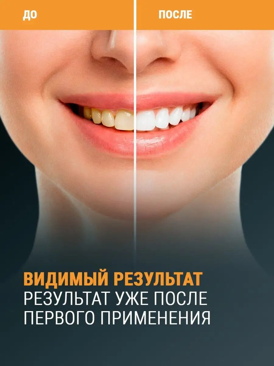 Отбеливающие полоски для зубов Asia Care, 28 штук — фото 1