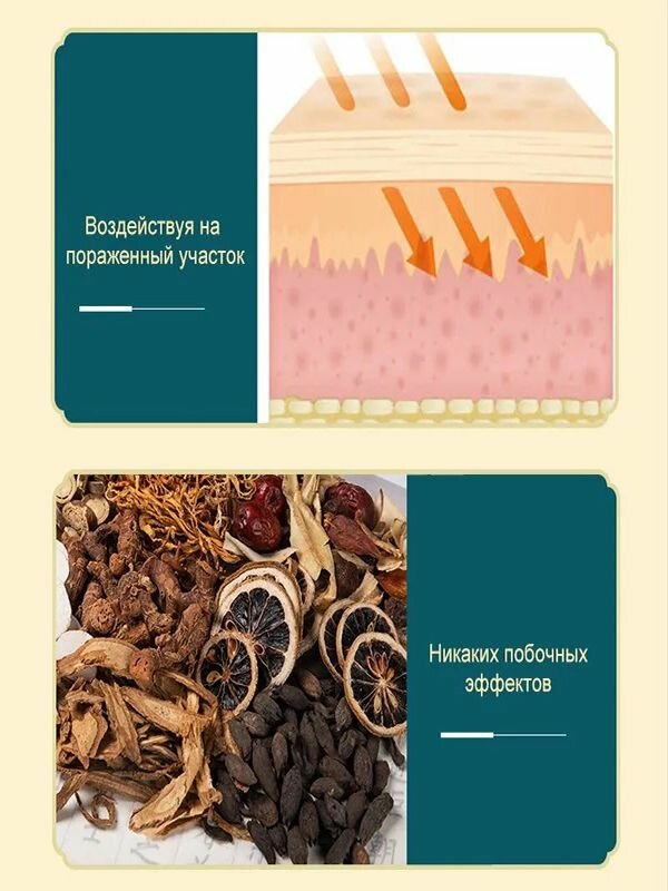 Изображение Мазь для суставов обезболивающая, для лечения подагры артрита и вальгусной деформации, обезболивающий от отеков ног от боли мышц,50g