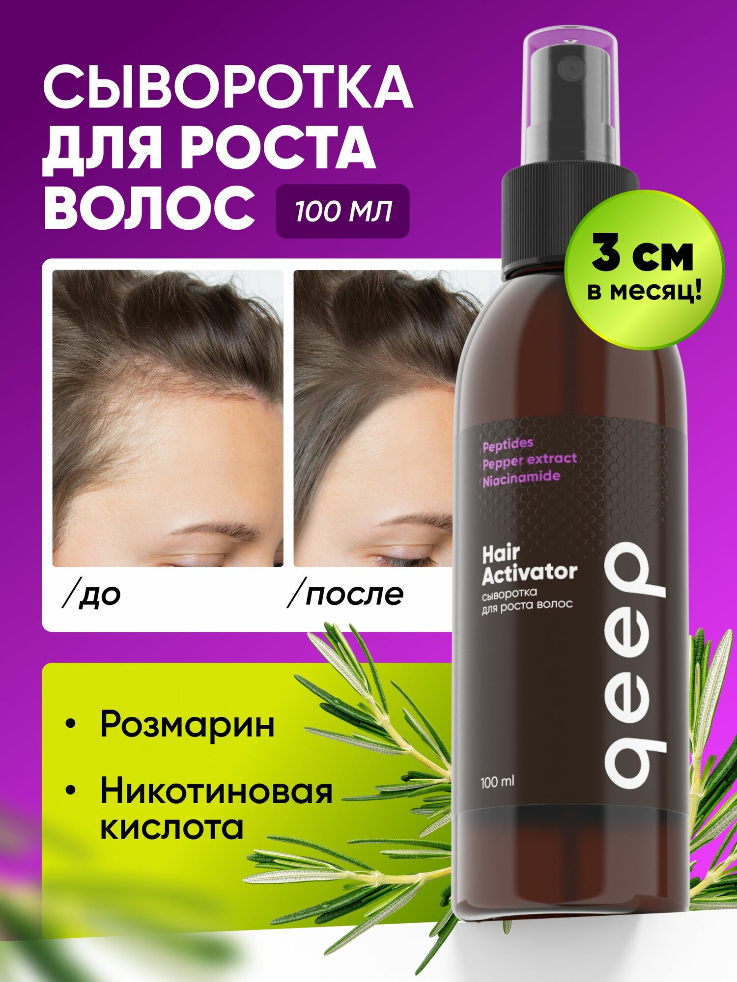 Спрей для роста и от выпадения волос, сыворотка для роста волос активатор qeep 100 мл