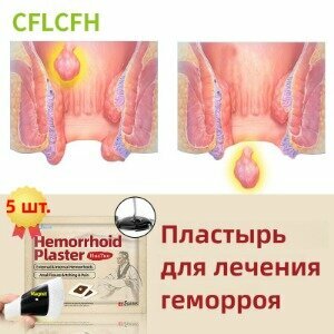 Пластырь от геморроя и анальных трещин HuaTuo  Геморект 100 натуральная не гормональная Китайская чудо пластырь