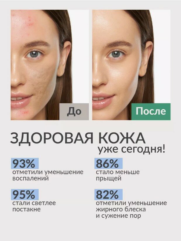Препараты От Угревой Сыпи Сыворотка анти акне с ниацинамидом цинком и чайным деревом от прыщей