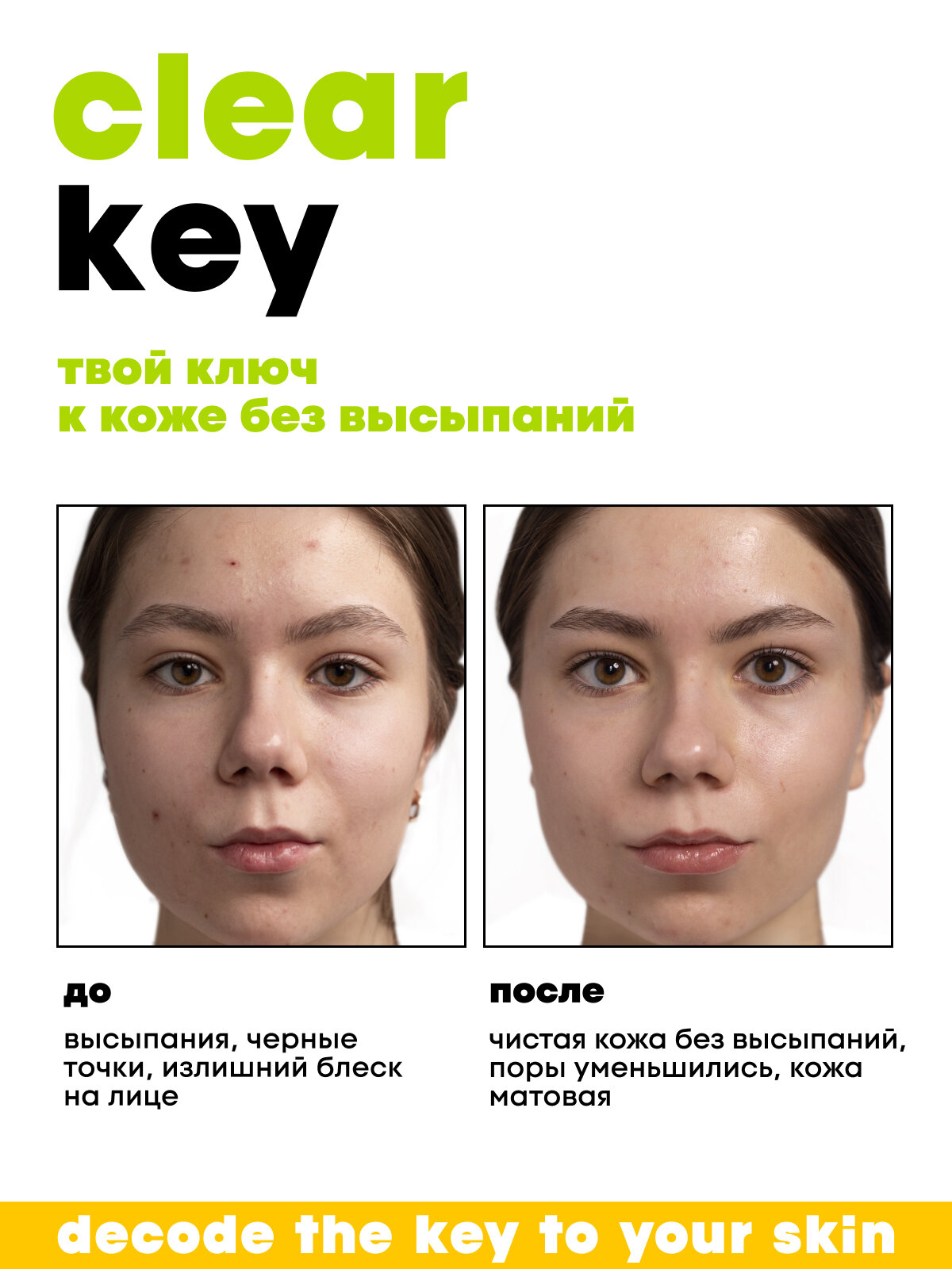 Лосьоны Для Лица Лосьон для лица против черных точек с салициловой кислотой DECODE, 150мл