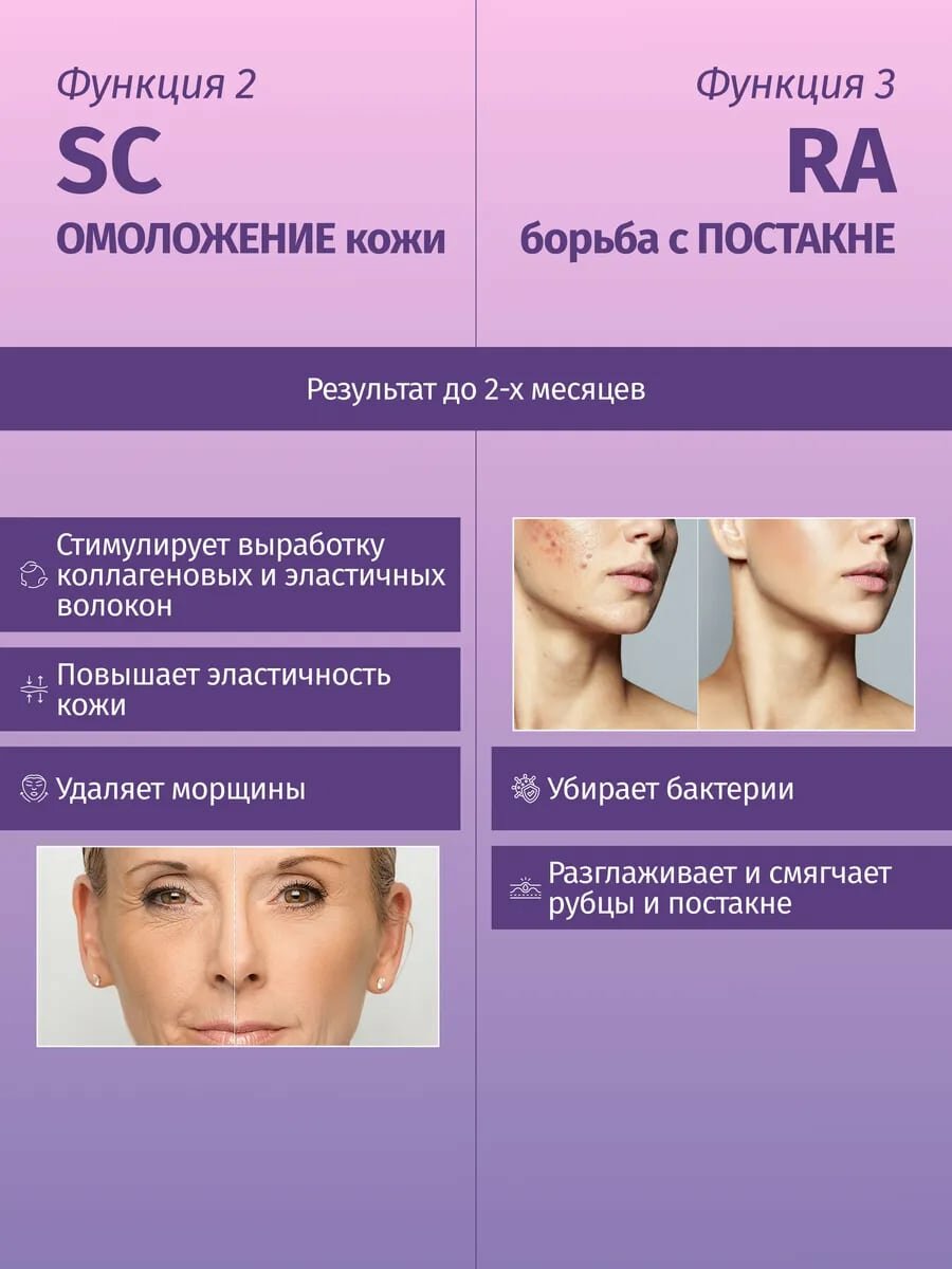 Фотоэпилятор, лазерный, 9 режимов, мощность вспышек 1.6-5Дж/см², белый — фото 1