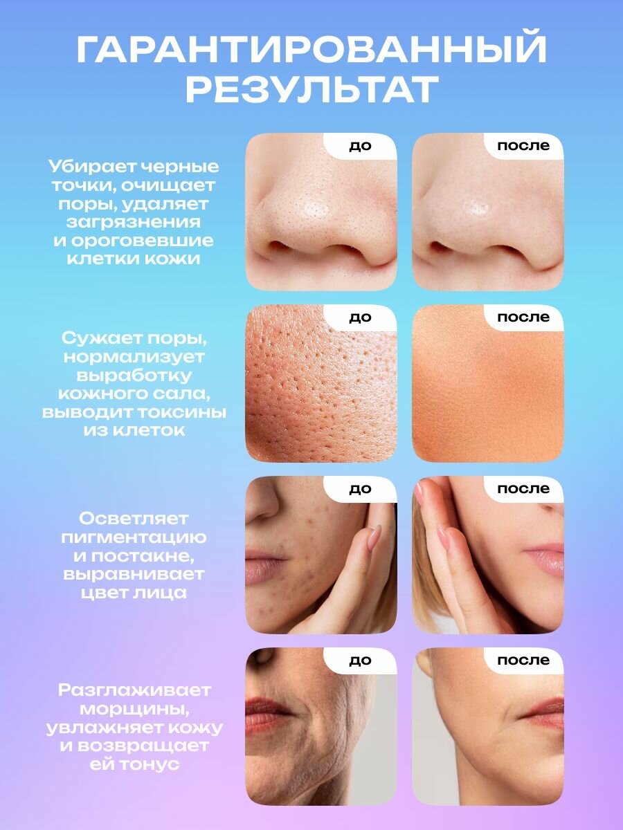 Doctor Comfort Ультразвуковая чистка лица US-4, аппарат для уз чистки, лифтинга, питания и увлажнения кожи, скрабер — фото 1