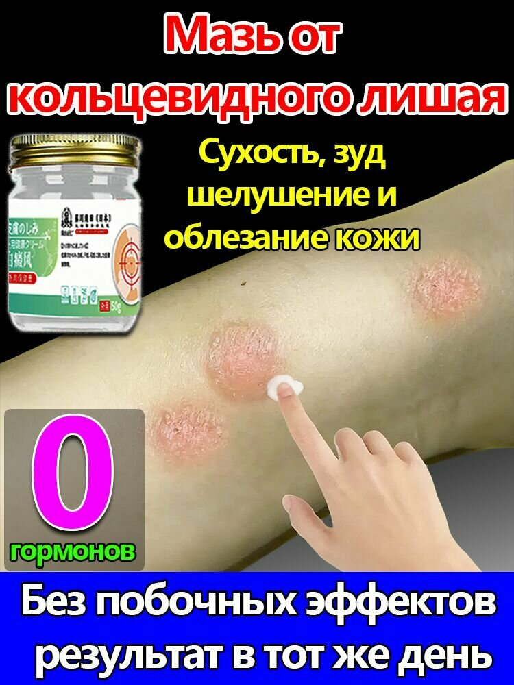 Устраняет стригущий лишай (кольцевидный лишай)