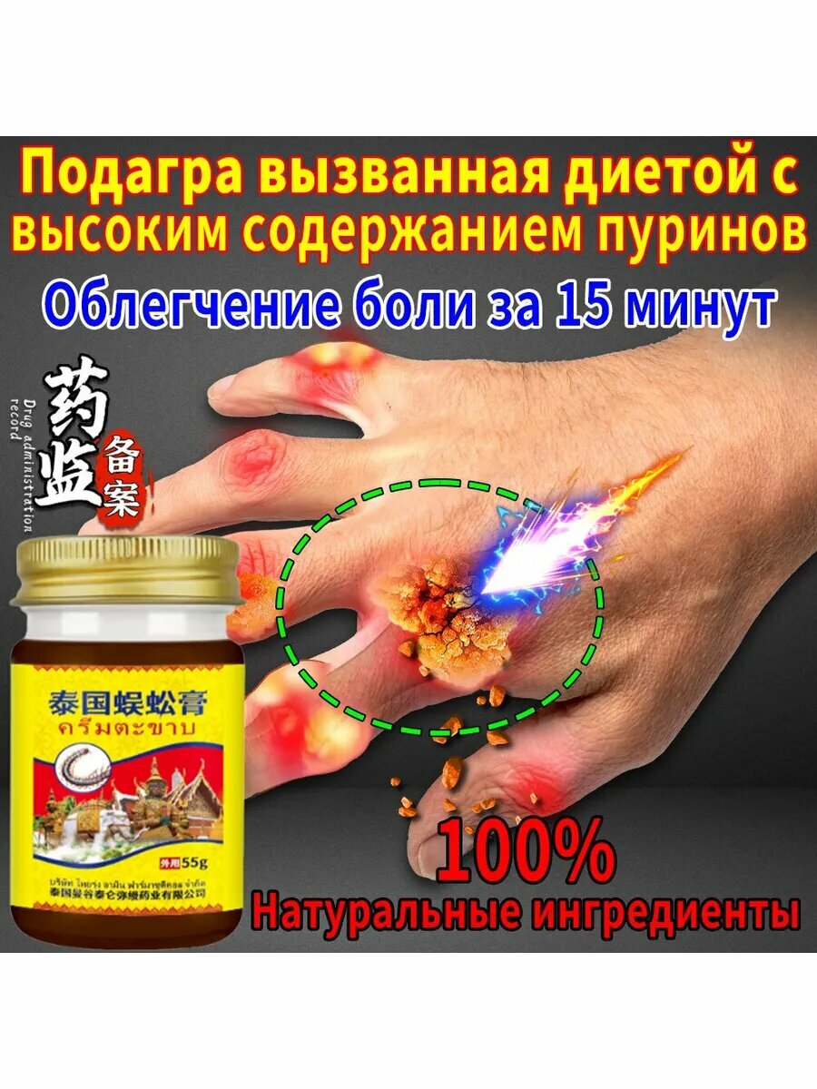 Мазь от подагры на ноге и для рук и артрита