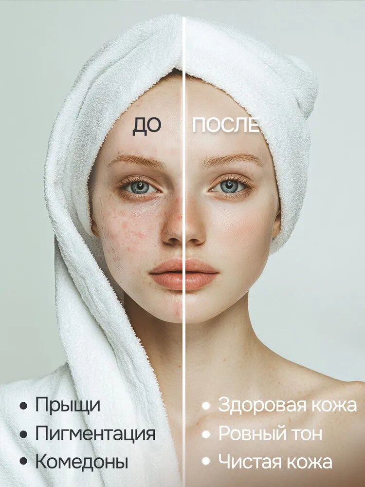 Картинки Цеолит пищевой природный для проблемной кожи лица, от прыщей, угрей, высыпаний, акне, ЗдравЛидер 200 гр