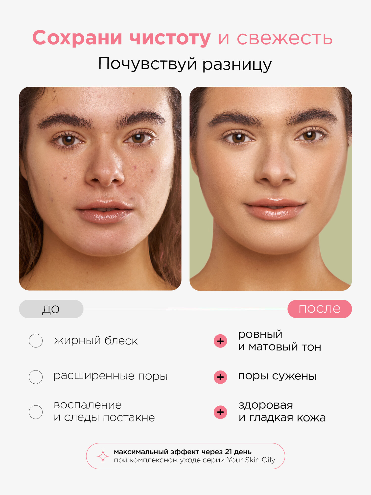 MIXIT Тоник для лица матирующий "Your Skin", для всех типов кожи, с ниацинамидом, 150мл — фото 1