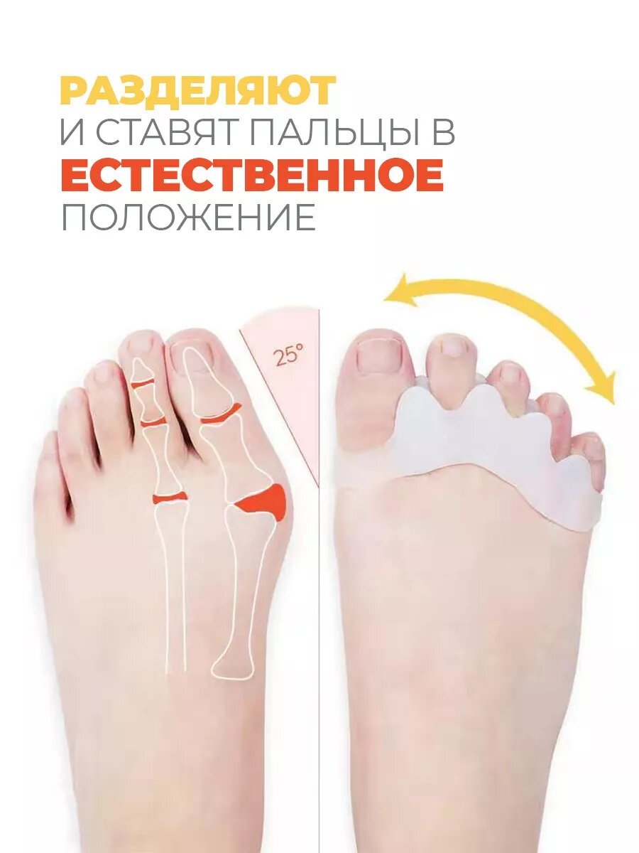Картинки Ортопедические межпальцевые разделители