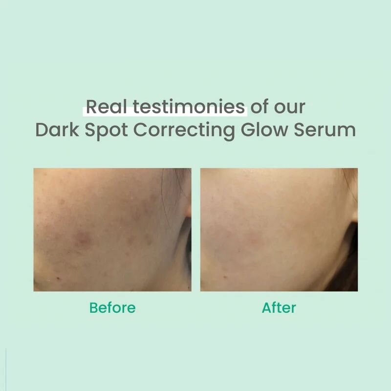 Картинки AXIS-Y Dark Spot Correcting Glow Serum, 50 мл Осветляющая сыворотка с 5% ниацинамида и глутатиона, увлажнение и борьба с пигментацией