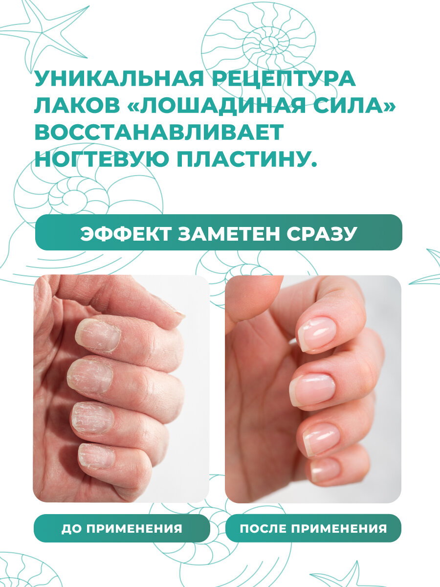 Лак лечебный Реаниматор для расслаивающихся ногтей, Лошадиная Сила с Витамином F прозрачный, укрепляющее средство 10мл — фото 1