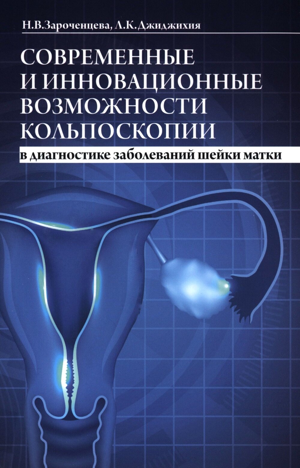 Современные и инновационные возможности кольпоскопии в диагностике заболеваний шейки матки. 2-е изд, доп. и перераб. Зароченцева Н. В, Джиджихия Л. К. МЕДпресс-информ