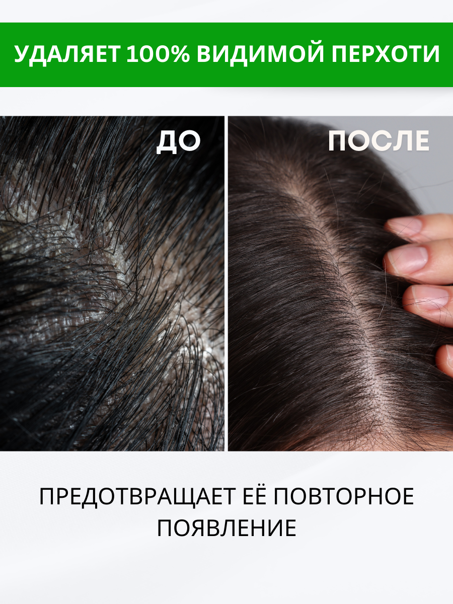 Изображение Сыворотка для волос от перхоти, зуда с цинком и климбазолом, 100мл, Doctor Heiler